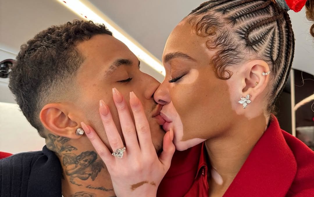 Winnie Harlow Is a Fiancé! Here’s Our Self-Care Guide for Brides-to-Be